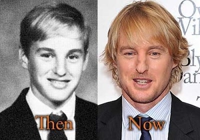 A picture of Owen Wilson before and after.